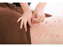 身体の困りごとは何でもご相談ください☆[整体/骨盤矯正/鍼灸]