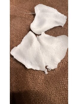 ブライズ(BRISE)/鼻周りの角栓