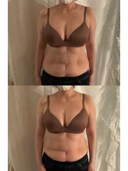 ハートランド(HEARTLAND)/泉区レモンボトル泉区ヘッドスパ