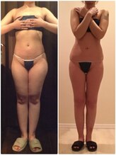 プラチナアース つくば店(Platinum earth)/痩身ビフォーアフター