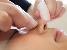 トトサロン(toto salon)/最新毛穴洗浄エクストラクション