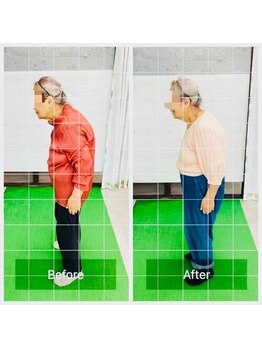 門前仲町イエティ鍼灸整骨院（旧：イエティ鍼灸整骨院）/８０代でも諦めないで！姿勢改善