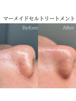 ビューティービューティー(BEAUTY BEAUTY)/