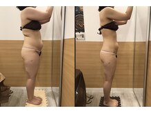 リッツ 草加店(Ritz)/【Before/After】痩身