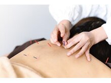 ロノ(Lono)/背中の鍼