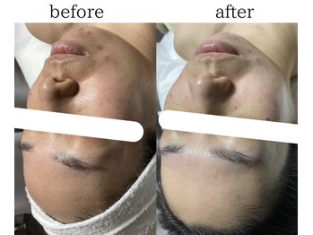 リノセス(Linocess)/トーンアップ/毛穴のひきしめ