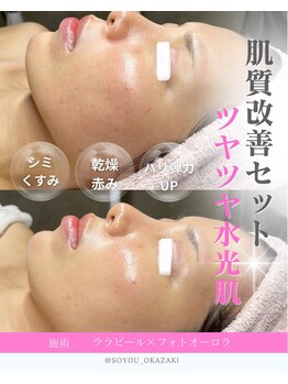 ソユ(SOYOU)/施術* &nbsp;&nbsp;&nbsp;&nbsp;ララピール×フォト