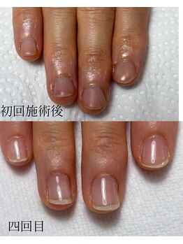 ハンド ケイ(Hand K)/自爪育成