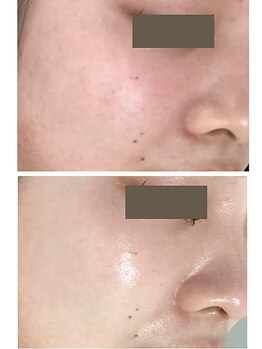 レクラ バイ ドクターエイチ(L'ECLAT by Doctor.H)/ララピール