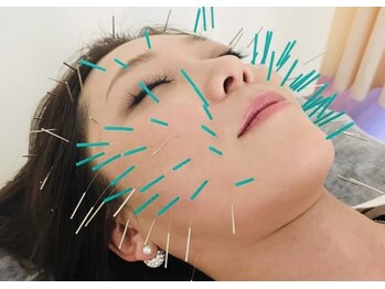 りゅうた整骨院 鍼灸院 宝塚中山寺店/美容鍼