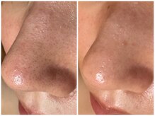 サラグランデ(Sara Grande)/お客様のお声