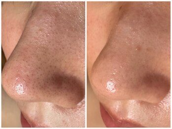 サラグランデ(Sara Grande)/お客様のお声