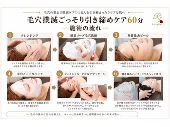 ローズフィールド(Rosefield)/毛穴撲滅ごっそり 施術の流れ
