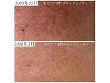 ドレッサー(Dresser)の雰囲気(美容サロンでなかなか改善できなかった凹凸・赤ら顔も!健康肌へ)