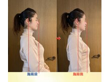 キワミ(KIWAMI)/＃整体＃恵比寿＃首専門