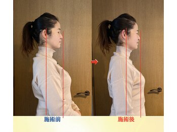 キワミ(KIWAMI)/＃整体＃恵比寿＃首専門