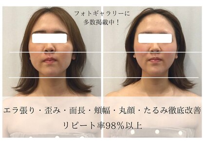 美極 トータルビューティー(美極 TOTAL BEAUTY)の写真