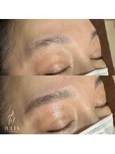 ジュリア(JULIA)/HBL（ハリウッドブロウリフト）