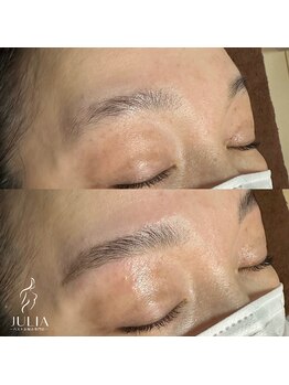 ジュリア(JULIA)/HBL（ハリウッドブロウリフト）