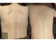 ジュエリーボディー(Jewelry body)/そしてもうすぐ夏が来ます！