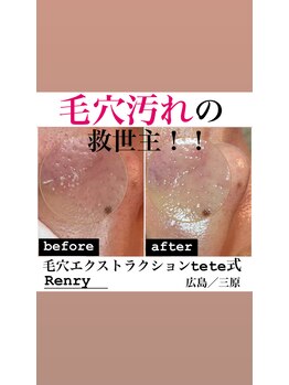 レンリー(Renry)/悩んでる時間がもったいない！