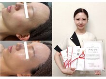 アンシャンテ 神戸元町店(Enchante)の雰囲気（"肌質改善"【韓国式水光肌ピーリング】毛穴レス艶美肌が人気◎）