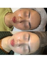 ココンフワット(Coconfouato)/毛穴レス肌質改善 アクアダーマ