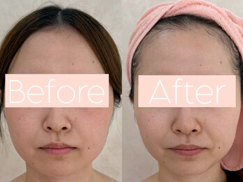 カレンジェビューティー(CarengeBeauty)/HIRFWAVE