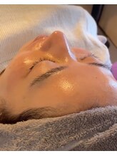 アイビー(ivy)/フェイスWAX＋マイクロニードル