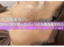 繰り返すニキビケアや凹凸肌ケア・毛穴にも効果を発揮！