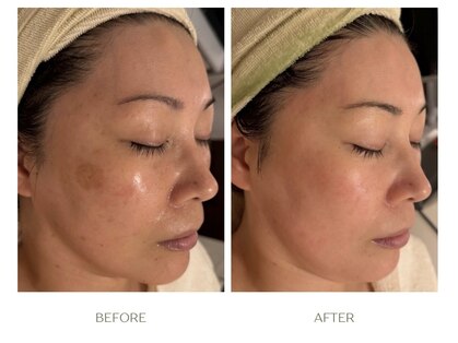 ラシェプリズ(LACHER PRISE)の写真