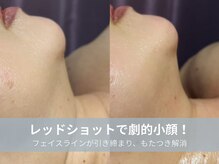 ラシック 加古川店(La chic.)/憧れのすっきり横顔美人に