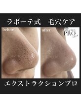 リベルテ 岡山(liberte)/毛穴ケアコース／初回 約120分