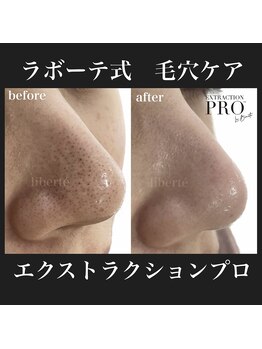 リベルテ 岡山(liberte)/毛穴ケアコース/初回 約120分