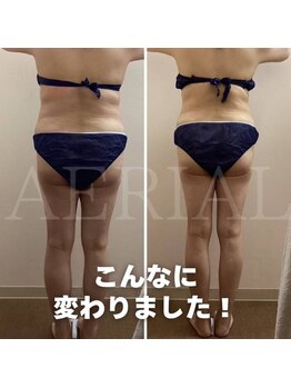 エアリアル 八女店/後ろ姿もスッキリ！