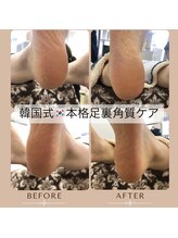 ココネイル 六十谷店(coco Nail)/本格☆韓国式足裏角質ケア