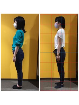 キラリ(KIRARI)/姿勢改善