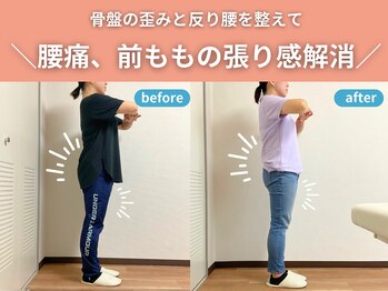 整体院カイト/【骨盤の歪み、腰痛】