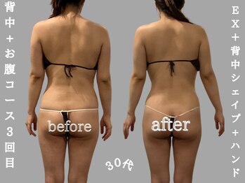 ソウソウビューティー 五反田(Shou Shou Beauty)/ビフォー☆アフター