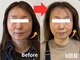 エレミュー(Elemue)の写真