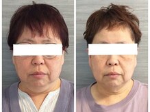 ウェリナ平和堂長久手院/小顔矯正/骨盤矯正/美脚サロン