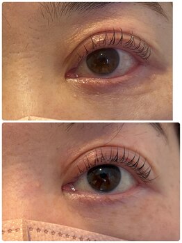 ヴェルソー(Verseau)/ NOBIRULASH-LIFT