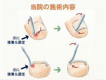 ぱんだ鍼灸接骨院 福井市巻き爪センターの雰囲気（痛みの少ない施術内容なので0歳からでも可能です◎）