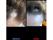 美バリ 新宿店(美BARI)/エアバリで頭の悩みを解決