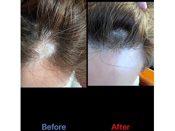 美バリ 新宿店(美BARI)/エアバリで頭の悩みを解決