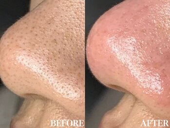 サロン ムスブ(salon MUSUBU)/山梨エステ/甲府エステ