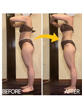 アーユルヴェーダアンドアロマエステ アユス(AYUS)/痩身1回でのビフォーアフター