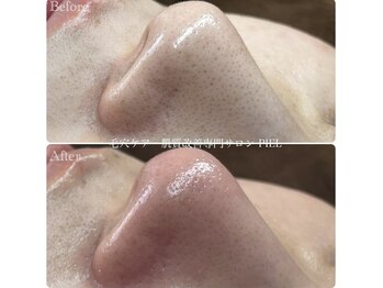 ピエル 北千住店(PIEL)/春のキャンペーン