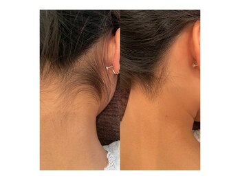 サロン ド スカイ(Salon de sky)/女性・うなじ