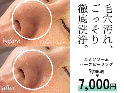アンベリール 横浜店(Embellir)の写真